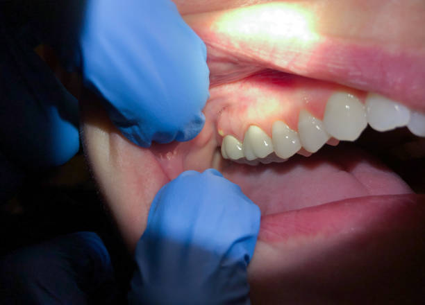 Best Mobile Emergency Dentist in Glastonbury Center, CT