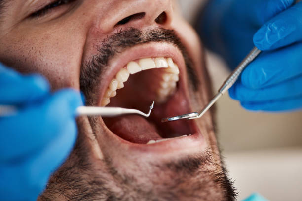 Best Emergency Dentist for Lost Fillings or Crowns in Glastonbury Center, CT